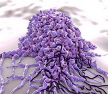 Slider image (4) Alternative Cancer Therapies by Center for Advanced Medicine